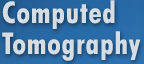 Computed Tomography - Midlands Musculoskeletal Imaging